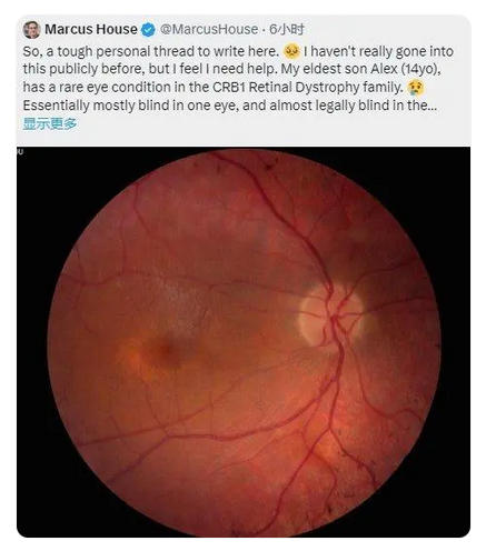 馬斯克：正在研發(fā)視覺芯片 可幫助失明者重見光明