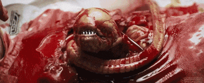 醫(yī)生從患者肚子里扯出一條活鰻魚(yú) 這不比異形還刺激