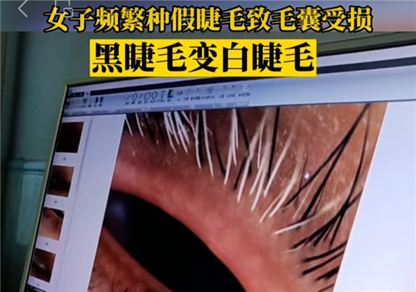 那些總戴假睫毛的人：現(xiàn)在都怎么樣了