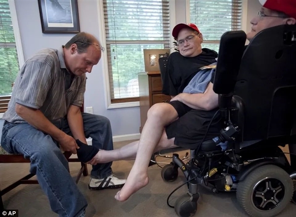 腹部相連只能輪流睡覺：世界最長(zhǎng)壽男性連體雙胞胎 68歲同時(shí)去世