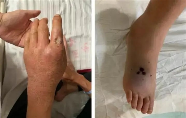 五步蛇在中國并不是最毒的 卻是最危險的！