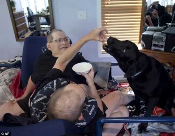 腹部相連只能輪流睡覺：世界最長(zhǎng)壽男性連體雙胞胎 68歲同時(shí)去世