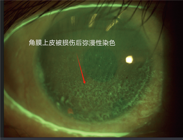 那些總戴假睫毛的人：現(xiàn)在都怎么樣了