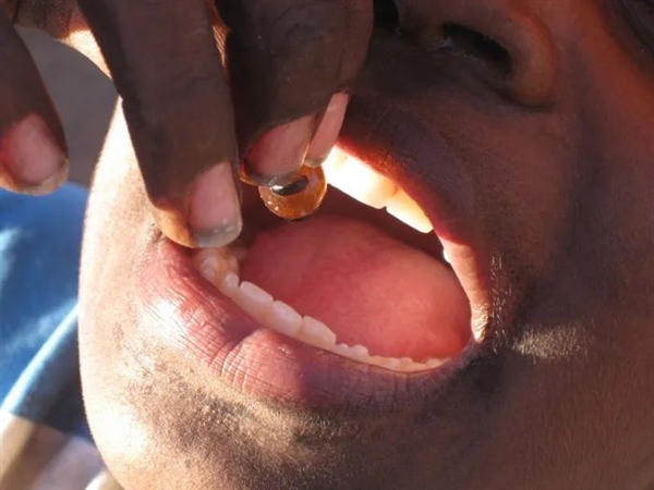 螞蟻吃起來(lái)是什么味道 云南人說(shuō)又酸又脆