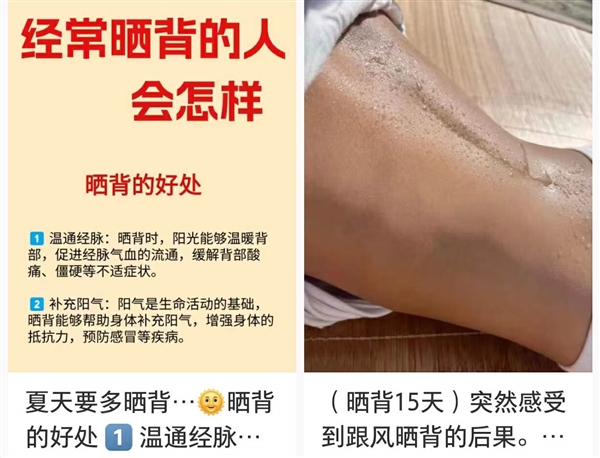 過度防曬的年輕人 開始沉迷曬背