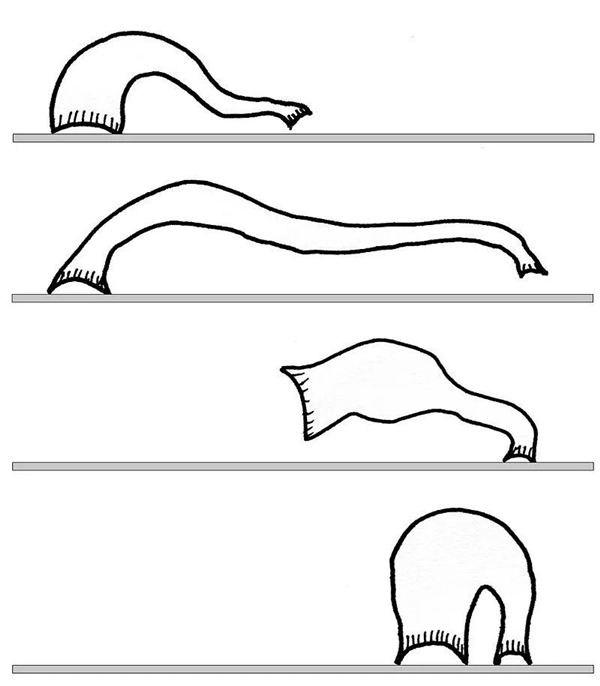 野外用河水洗了把臉：廣東男子鼻子里拽出5cm長水蛭！