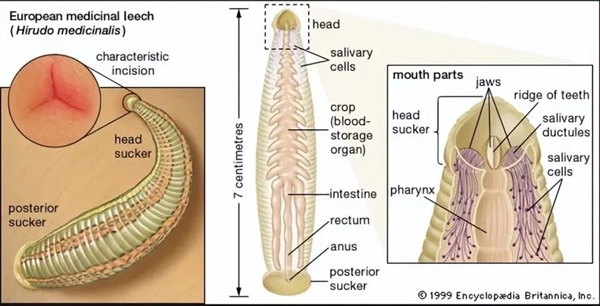 野外用河水洗了把臉：廣東男子鼻子里拽出5cm長水蛭！