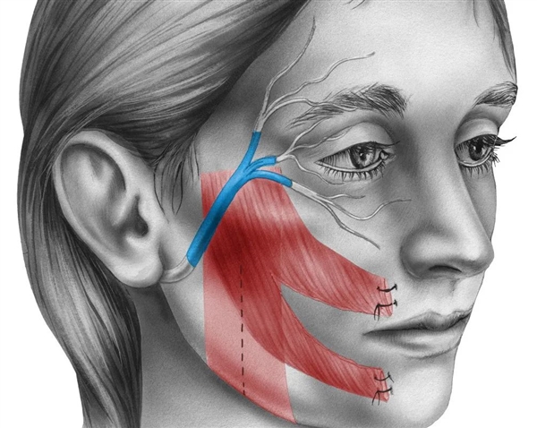 吹空調(diào)吹出面癱！醫(yī)生揭露真相：不能怪空調(diào)