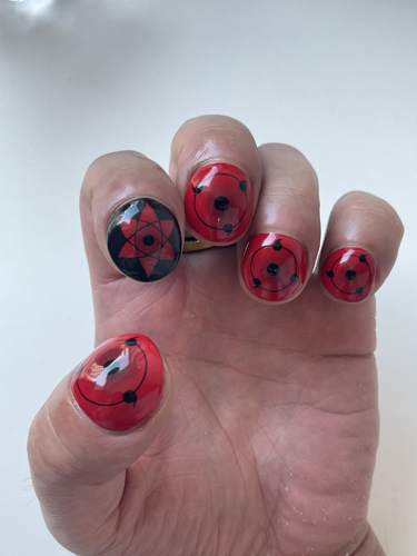 日本小哥手指腫得像乒乓球：結(jié)果被他解鎖了先天洗頭圣體！