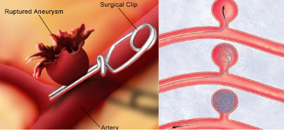 知名男歌手臺上高歌致腦出血不幸離世！這類人唱歌千萬要小心