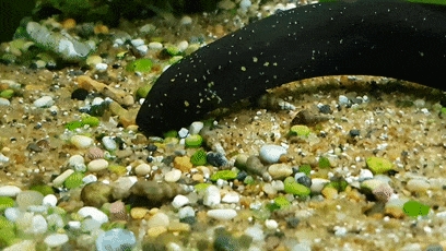 醫(yī)生從患者肚子里扯出一條活鰻魚(yú) 這不比異形還刺激