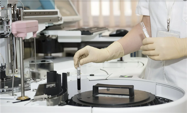 美國(guó)開(kāi)發(fā)出“癌癥生存計(jì)算器”：可預(yù)測(cè)患者生存率