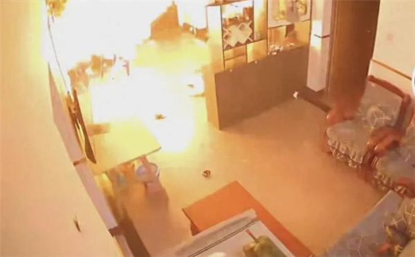 醫(yī)生回應(yīng)燒傷媽媽“鋼絲球清創(chuàng)” ：這是最佳治療手段