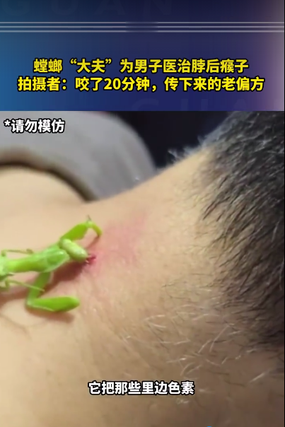 螳螂“大夫”為男子醫(yī)治脖后瘊子引圍觀：20分鐘吃完 老偏方 醫(yī)生發(fā)聲