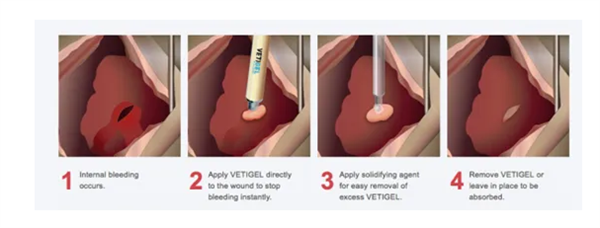 10秒內(nèi)止血堪比游戲道具！美國FDA批準(zhǔn)止血凝膠上市