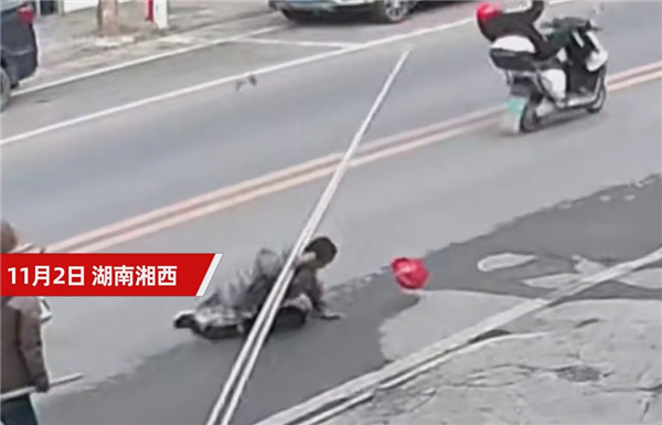 摩托車騎手撞上鋼管 導(dǎo)致粉碎性骨折:仍在ICU(圖4) 摩托車騎手撞上鋼管 導(dǎo)致粉碎性骨折:仍在ICU