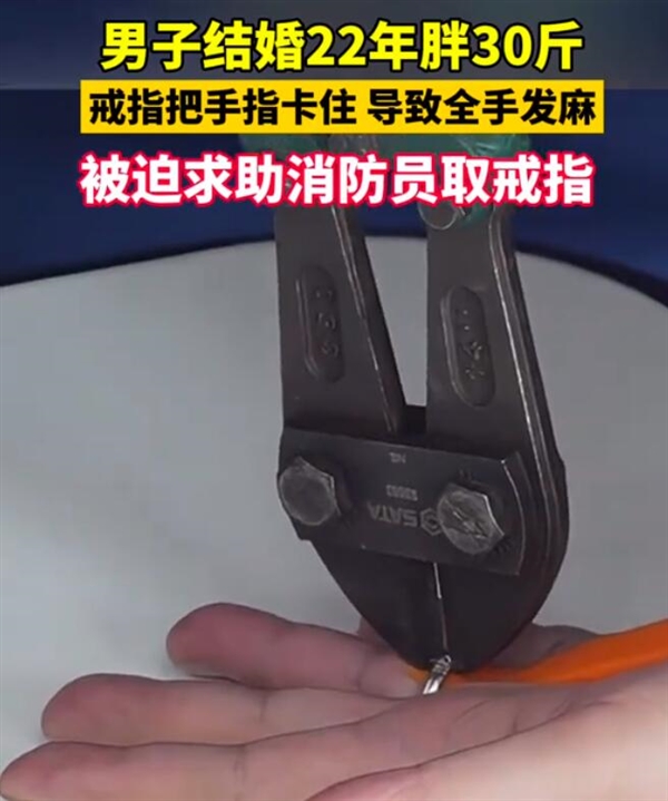 男子結(jié)婚22年胖30斤無奈夾斷婚戒：整個(gè)手都發(fā)麻了